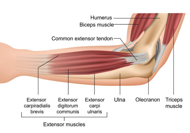 Ulnar Nerve Injury