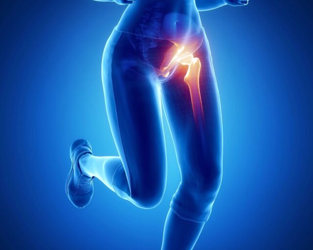 Hip Joint Pain